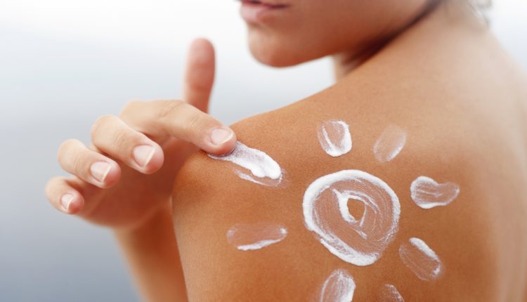 How to treat sunburn this summer and avoid it for the future