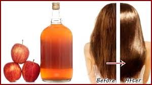 5 Excellent Benefits of Apple Cider Vinegar to Your Health