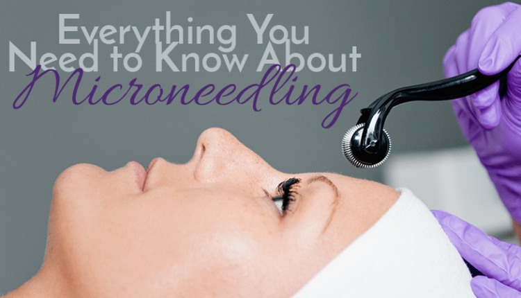 Everything You Should Know About Microneedling