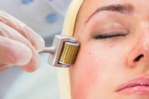 Everything You Should Know About Microneedling