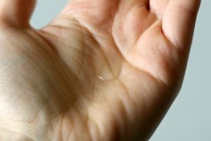 Niod Multi-Molecular Hyaluronic Complex