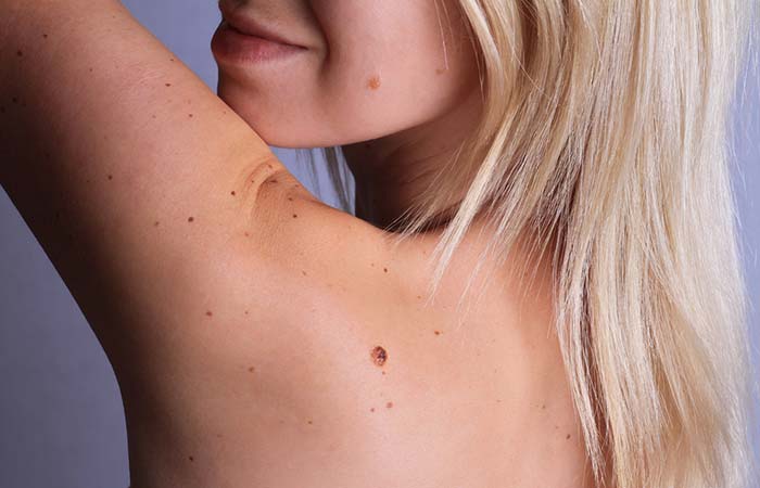 7. Development Of New Moles